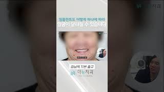 연세는 70대 치아는 20대?