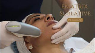 Skin Rejuvenation With E-matrix Sublative