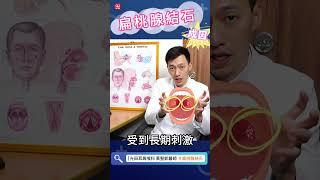 你也有這個壞習慣嗎？揭開扁桃腺結石罪魁禍首！#扁桃腺 #扁桃腺結石 #扁桃腺炎  #耳鼻喉頭頸部 #光田醫院 #黃聖凱醫師