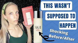 SK-II Pitera Essence vs Cosrx Galactomyces…