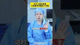 甲状腺癌都是自找的，学会这个自检方法 #医疗健康创作训练营 #抖出健康知识宝藏 #甲状腺 #体检 #关爱女性健康