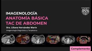 TAC DE ABDOMEN - ANATOMÍA RADIOLÓGICA BÁSICA