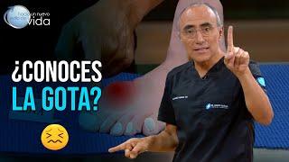 ¿Conoces la Gota? 