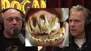 Jre Adam Curry and his teeth infection