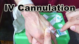 How to Insert IV Cannula | IV Cannulation Technique | Branula | Intravenous Catheter