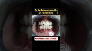 Smile Creation ️ #omkarananda #dental #teeth #teethcleaning #teethwhitening #smile #dr #sourav