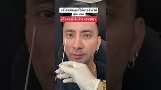 หลังฉีดฟิลเลอร์ใต้ตา 1 ข้างให้ คุณบอล เชิญยิ้ม สดชื่นเลยทันที