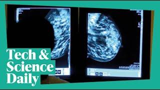 Breast cancer research breakthrough ...Tech & Science Daily #podcast