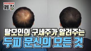 탈모 전문가가 알려주는 두피 문신의 모든 것(feat. 삭발과 헤어라인) 1부-[난JOB한 이야기]