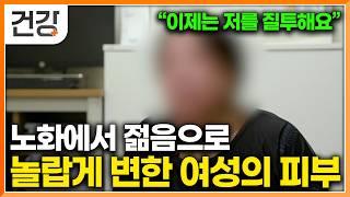 "이제는 제 피부를 질투해요" 자외선 노출로 인한 피부 광노화 되돌릴수 있다면!? │자외선 차단제 선택법│피부 노화 예방법│명의│#EBS건강