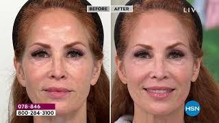 NassifMD MicroSpa Radiance Resurfacing Peel