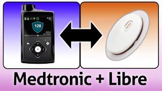 Medtronic's New CGM Powered by Libre - Explained