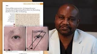 Restoring Scarred Eyebrows One Hair at a Time – Video Discussion by Sanusi Umar, MD, FAAD