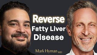 Early Signs of Fatty Liver Disease You Can’t Ignore | Dr. Yousef Elyaman