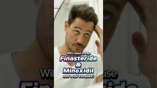  Will I need to use Finasteride or Minoxidil after a hair transplant?