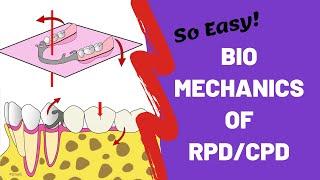 Biomechanics of Removable Partial Dentures | Prosthodontics