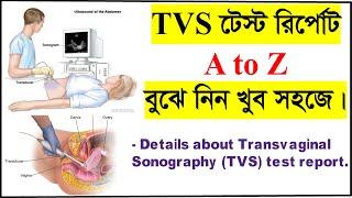 TVS টেস্ট রির্পোট বুঝার সহজ উপায়। How to read Transvaginal ultrasound or TVS test report? TVS test