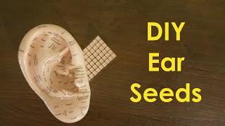 Do-it-yourself Ear Seeds