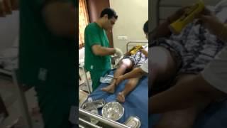 Stick Remove After TKR total replacement surgery in Ahmedabad - Dr. Tejas Gandhi