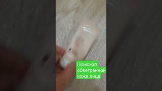 Обветренная кожа