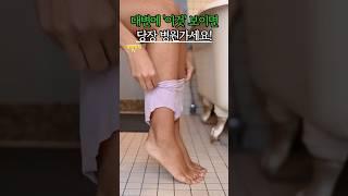대변에 '이것' 보이면 당장 병원으로 달려가세요!  #건강 #건강정보