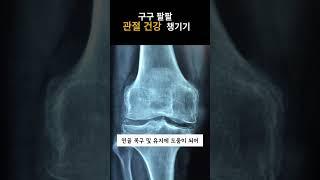 구구 팔팔 관절 건강 챙기기, #관절, #건강, #글루코사민,  #콘드로이친