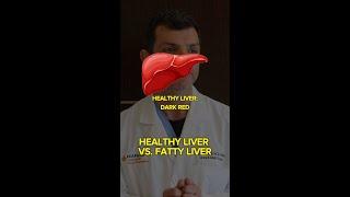 Healthy Liver VS. Fatty Liver