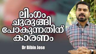 പുരുഷന്മാരിലെ ശേഷിക്കുറവ്  ഇതാണ് കാരണം  ഈ പ്രശ്നം ജീവിതത്തിൽ വരില്ല ഇങ്ങനെ ചെയ്താൽ/ Dr Bibin Jose