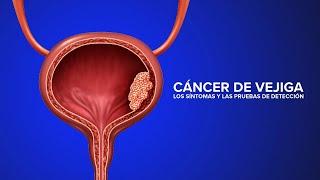 Cáncer de Vejiga - Los síntomas y las pruebas de detección