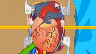 OPERATE NOW : HEART SURGERY | PLAY SURGERY GAMES