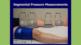 IAC & SVU Present: Performance and Interpretation of Arterial Physiologic Testing