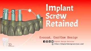 Implant Screw Retain