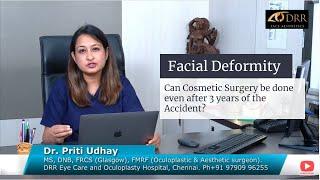 Treating facial deformity and sunken eye with cosmetic correction  - Face Reconstruction Surgery