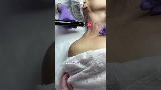 Омоложение лица, шеи и декольте