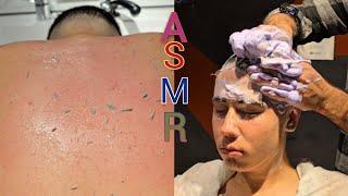 HEAD MASSAGE AND BACK DIRT REMOVAL ASMR SLEEP MASSAGE