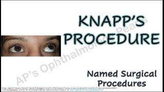 Knapp’s procedure | Named Surgical Procedures