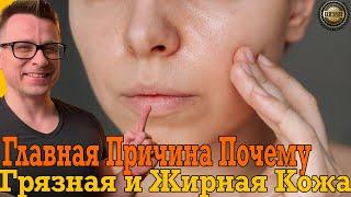 Грязная и жирная кожа останется в прошлом! Как быстро избавиться от акне и прыщей!