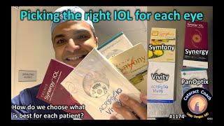 CataractCoach 1174: picking the right IOL each eye: PanOptix, Synergy, Vivity, Symfony