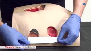 How to Measure a Wound | Measuring Wound Dimensions | Ausmed Education