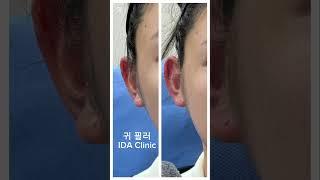 연예인들이 우리 병원에서 많이 하시는 시술이 무엇인지 아시나요?