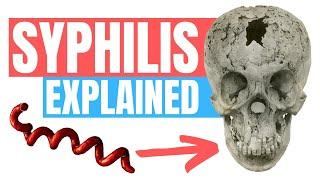 Do you have Syphilis? - Symptoms, Tips and Treatment - Doctor Explains