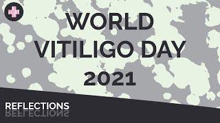 Joti Reflects on World Vitiligo Day 2021