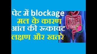 पेट की आंत में मल के फंस जाने या अटक जाने के कारण आंत में रूकावट के  लक्षण, खतरे और इलाज