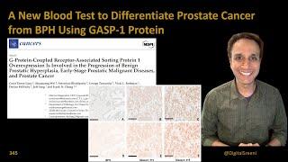 A New Blood Test to Differentiate Prostate Cancer from BPH Using GASP-1 Protein