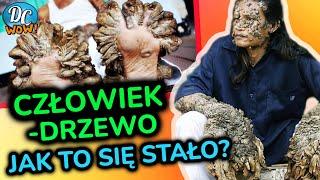 Człowiek - drzewo, czy historia Dede Koswary musiała się skończyć tragicznie?