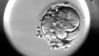 Timelapse of fertilisation of a human egg under the microscope