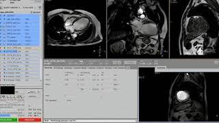 6. Live Scanning of CMR Dr  Pudhiavan