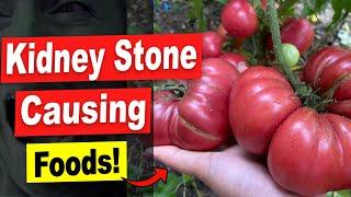 17 Foods That Turn Into Kidney Stones! Stop Eating These Kidney Stone Causing Foods!