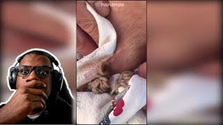THAT CAN'T BE A PIMPLE! | Top 10 PIMPLE POPPING COMPILATION
