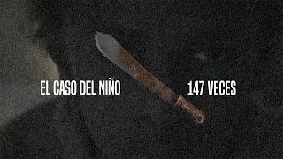 El Caso Del Niño Mutilado 147 VECES